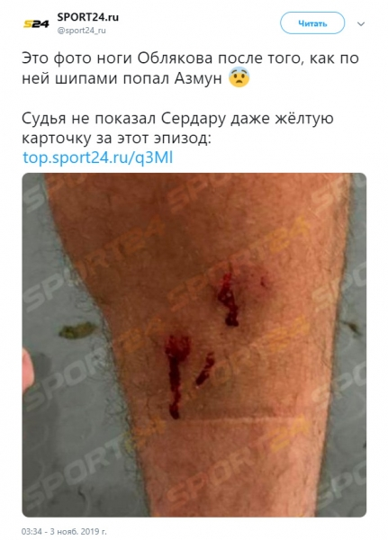 В сети появилось фото шрамов на ноге Облякова после фола Азмуна1