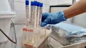 В России коронавирусом заразились менее 0,1% населения
