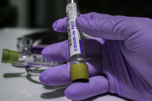 Комитет по здравоохранению зарегистрировал ещё 55 смертей от коронавируса в Петербурге