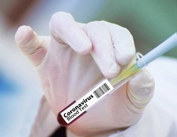 Американские журналисты и политики сфабриковали «заговор о происхождении коронавируса в китайской лаборатории»0