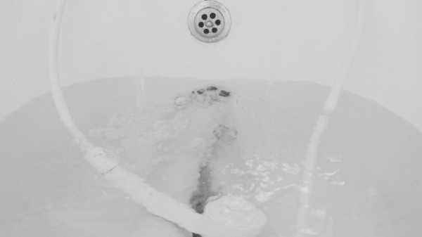 На Сахалине санитарка "сварила" в ванне девочку-инвалида