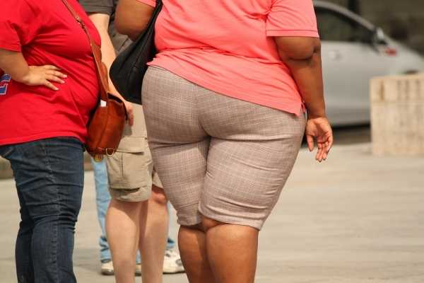 Роспотребнадзор: ожирение сокращает жизнь на срок до 15 лет0