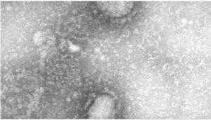В США подтвердился еще один случай заражения коронавирусом