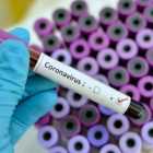 Пик распространения коронавируса будет в середине февраля