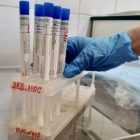 С марта по июль в Петербурге сделали 1,5 миллиона тестов на коронавирус