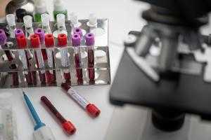 Центр Гамалеи представил журналу Lancet протокол исследования вакцины