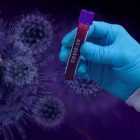 Стали известны сроки начала роста смертности из-за коронавируса