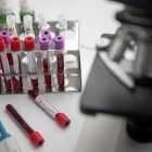 Российская вакцина от ВИЧ выработала антитела к вирусу