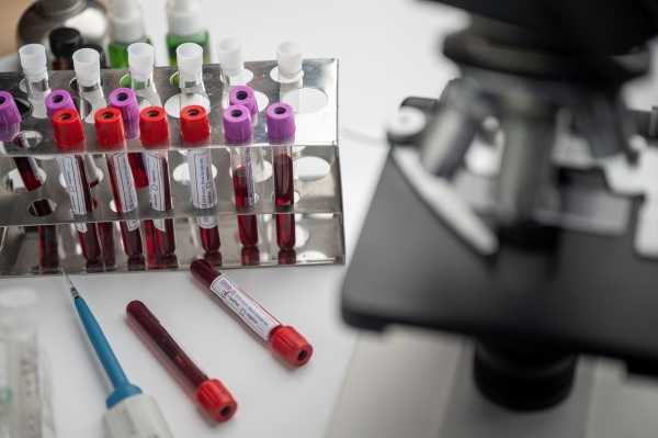 Российская вакцина от ВИЧ выработала антитела к вирусу0