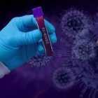 Врачи выявили необычный симптом коронавируса