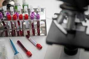 В Ленобласть с декабря поступило почти 50 тысяч комплектов вакцины от коронавируса