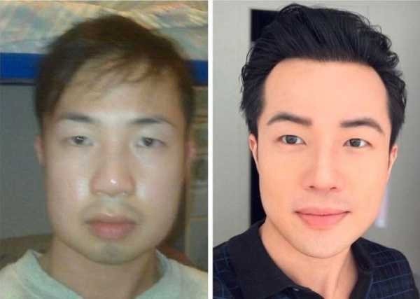 20 фото в стиле «до и после», на которых у людей меняется: вес, образ жизни и даже лицо