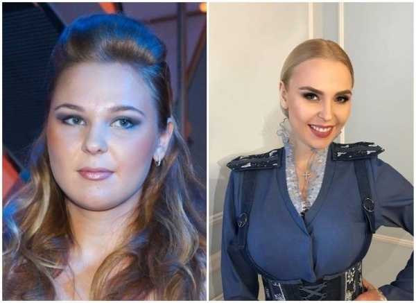 15 российских знаменитостей, которые заметно похудели и похорошели
