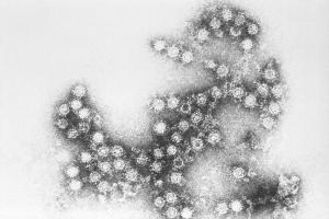 С начала года энтеровирусной инфекцией заразились более 60 петербуржцев