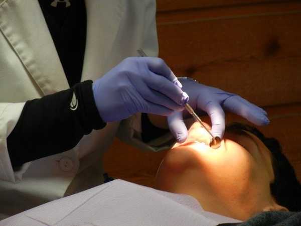 Петербургский стоматолог объяснил, как кариес может привести к раку0
