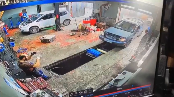 Российский автомеханик лишился ног после наезда машины клиентки0