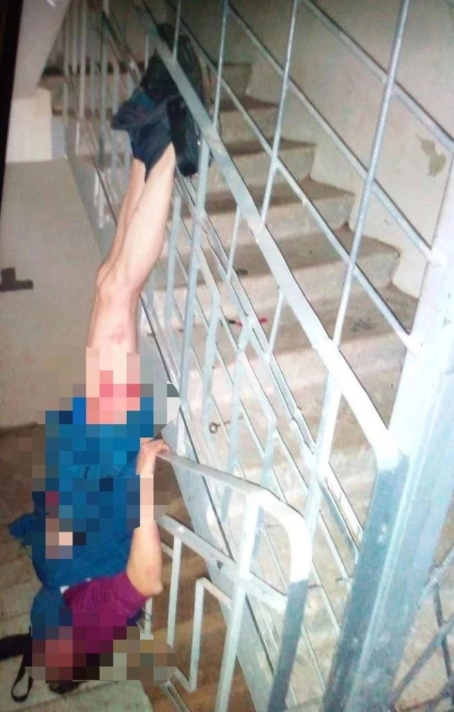 Наркоман без штанов повис на перилах лестницы в Петербурге1