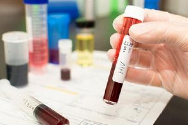 В Ленобласти на 8% снизилось число новых случаев ВИЧ 