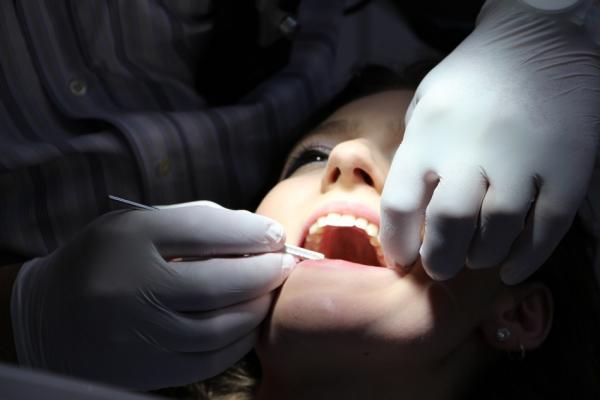 Стоматолог рассказала, почему желтеют зубы и как вернуть им прежний цвет 