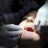 Стоматолог: потерять зубы можно из-за неправильного прикуса