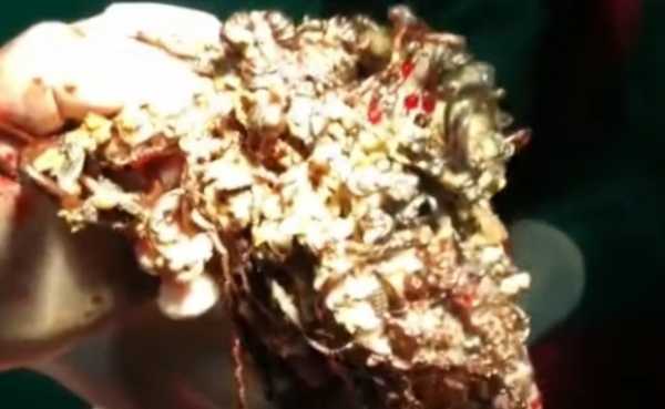 В Индии хирурги извлекли из желудка девушки 1,6 кг золотых украшений0
